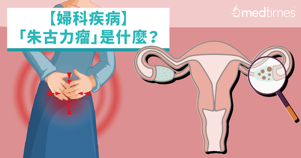 【妇科疾病】朱古力瘤是什么？